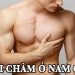 Trái chàm ở nam giới
