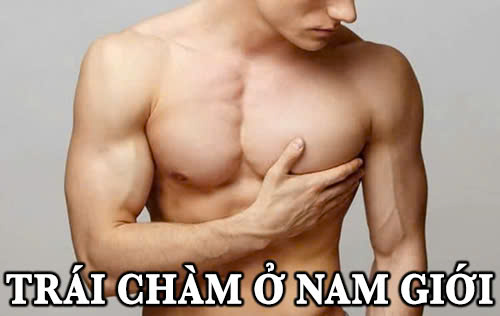 Trái chàm ở nam giới