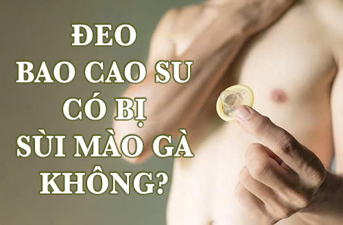 Đeo Bao cao su có bị sùi mào gà không